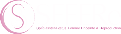 SFFERe